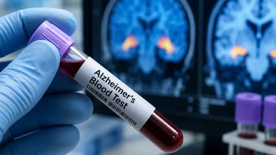 Gloved hand holds a blood sample labeled "Alzheimer's Blood Test" with brain scans in the background in a lab setting.